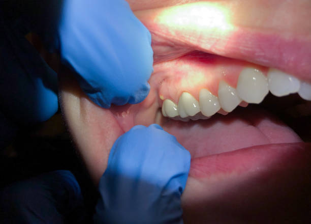 Best Pediatric Emergency Dentist in Honea Path, SC
